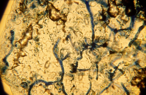 Photo 5: Blue-stained mycelium of downy mildew that has systemically infected lettuce tissues.