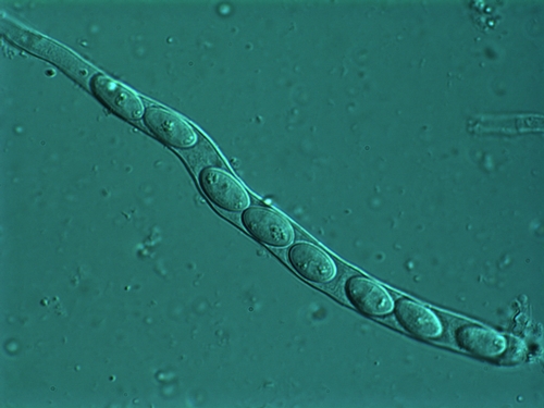  Microscopic view of ascospores lined-up in a tube (called an ascus) and ready to be released. Photo used by permission (J. Rollins).